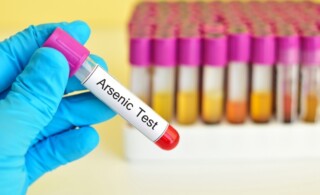 Arsenic test